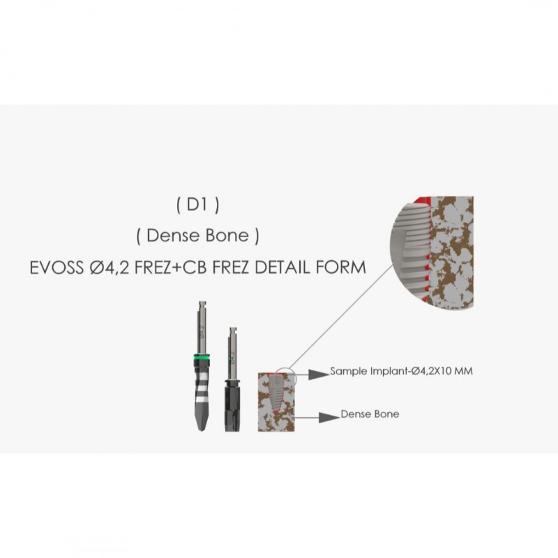 EVOSOFT 3.4x7mm - 7